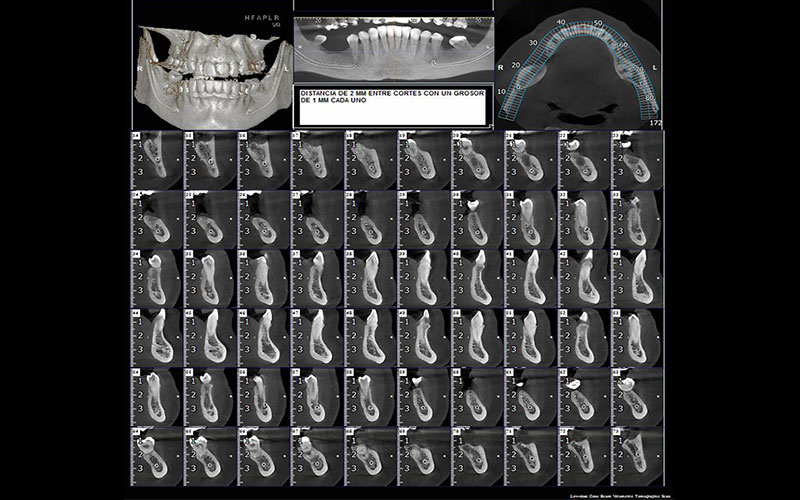 Configuración personalizada del escáner CBCT