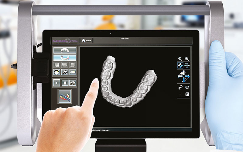 Formato digital STL abierto, compatible con los laboratorios CAD/CAM