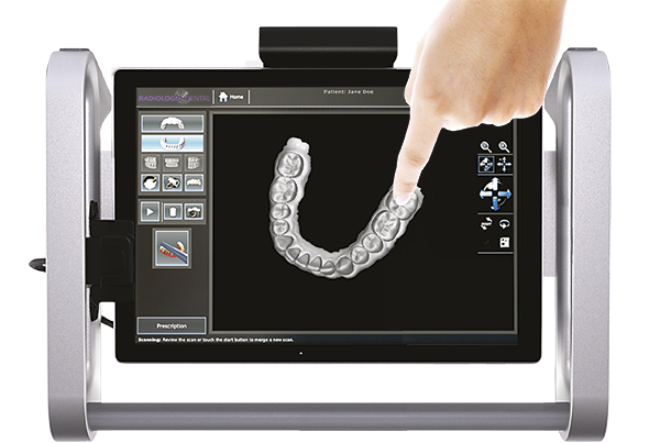 Escáner intraoral con la tecnología digital 3D más avanzada del mercado