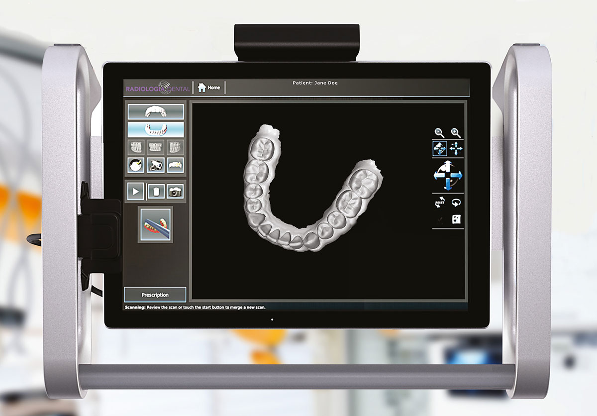 Escáner Intraoral - Escáner Intraoral 3D - Ortodoncia Invisible