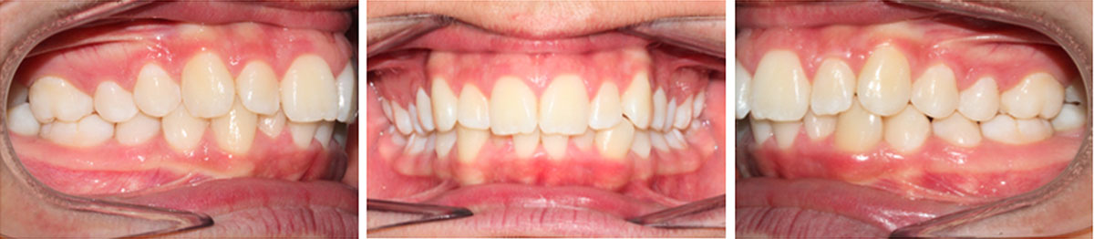 Estudio Fotográfico dental - Fotografía oral