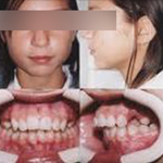 Estudio Fotográfia Dental - Fotografía oral
