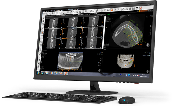 Escáner CBCT